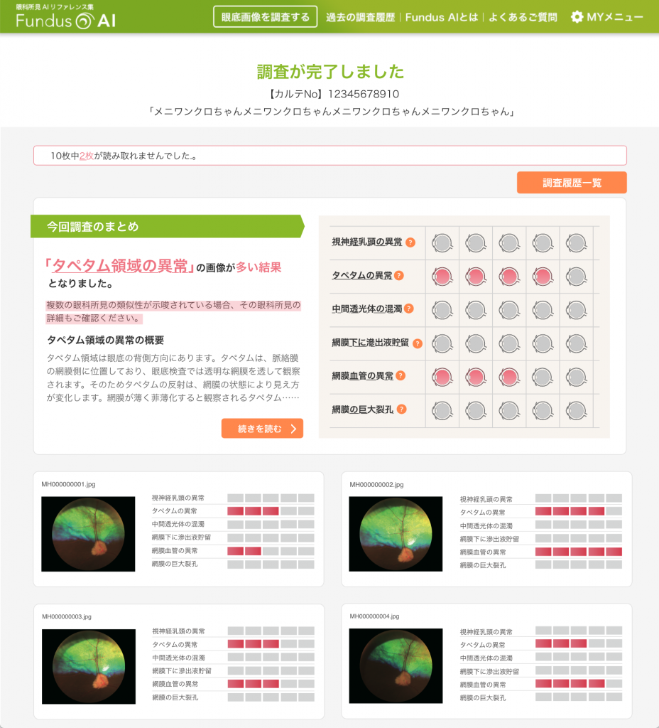 Fundus AI（ファンダスアイ）　画面イメージ1